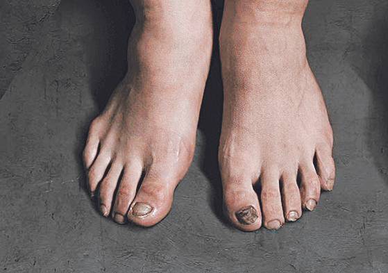 한국축구대표팀 에이스 손흥민의 울퉁불퉁한 발. [중앙포토]