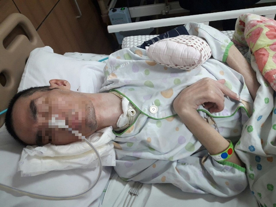 요양병원에 누워 있는 최모(41)씨 최근 모습. 혼수상태인 그의 목과 콧구멍에는 영양분과 산소를 공급하는 호스가 꽂혀 있다. 몸이 점점 굳어 사지가 뒤틀려 있다. [사진 최씨 부인]