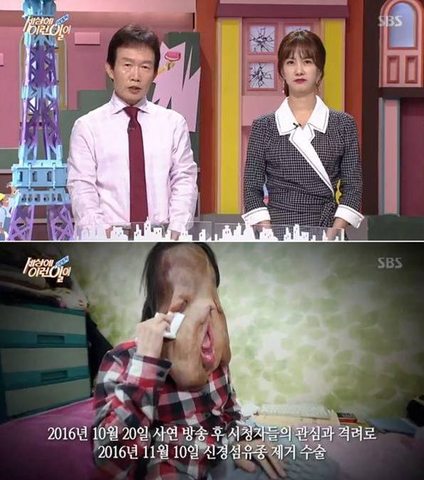 사진=SBS '순간포착 세상에 이런일이' 방송화면 캡처