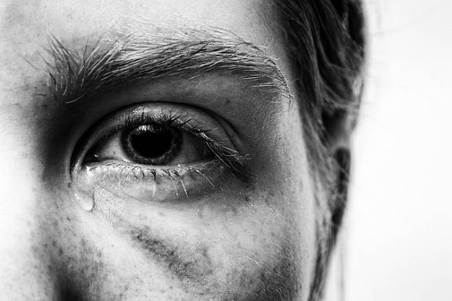 누구나 고통스러운 기억을 가지고 살아간다. 고통의 기억은 우리의 과거뿐 아니라 현재를 규정하고 재단한다. 트라우마에서 해방되는 일은 쉬운 일이 아니다. 우리 마음은 고통의 기억이 보다 잘, 보다 오래도록 남도록 진화했기 때문이다. - 픽사베이 제공