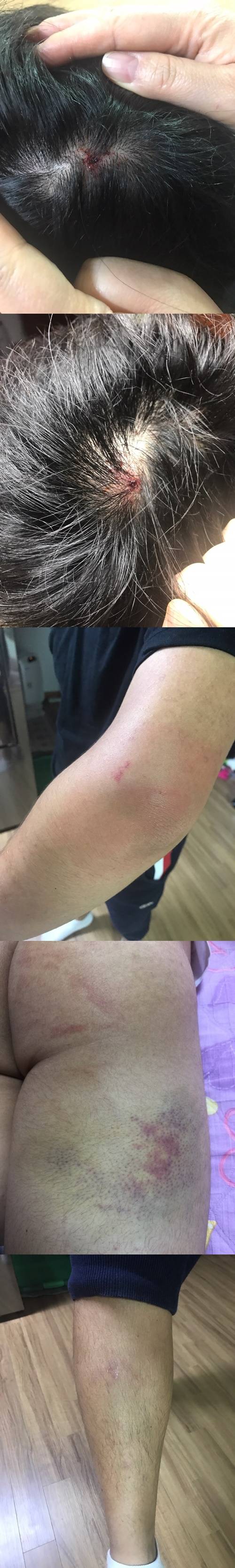 더 이스트라이트 이승현 폭행 사진=법무법인 남강