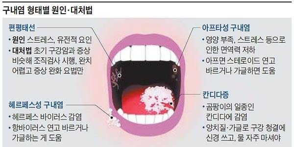 /그래픽=이지혜