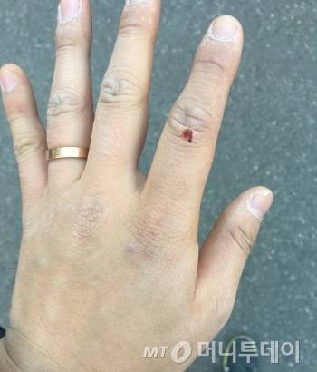 박스를 분해하다, 아스팔트에 긁혀 왼쪽 검지손가락에 생긴 상처. 장갑을 끼고 왔어야 했는데, 만만히 봤다가 큰코 다쳤다. 넷째 손가락을 잘 보면, 살쪄서 반지가 작아진 걸 확인할 수 있다(TMI)./사진=남형도 기자