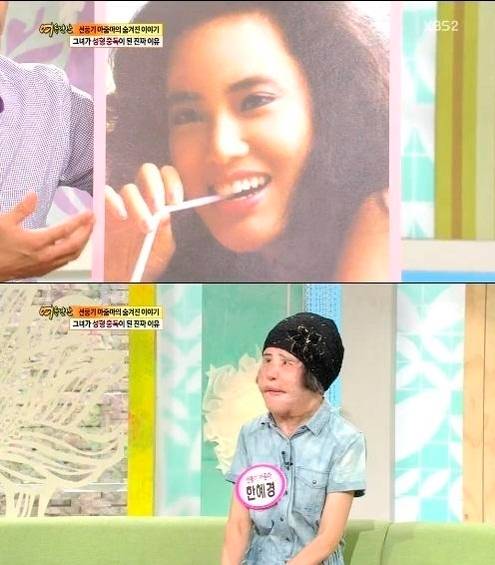 '선풍기 아줌마' 한혜경씨/사진=KBS 캡처 © News1