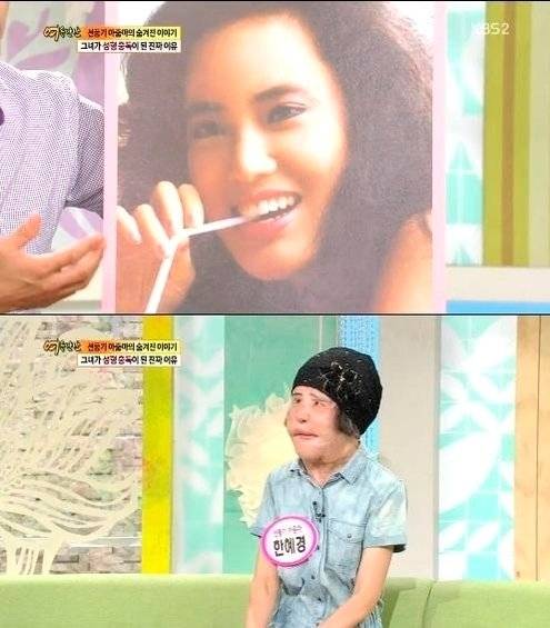'선풍기 아줌마'로 불리던 한혜경씨가 지난 15일 향년 57세로 생을 마감했다는 소식이 전해진 가운데 한씨의 성형 전 사진이 안타까움을 더하고 있다. [KBS 방송 캡처]