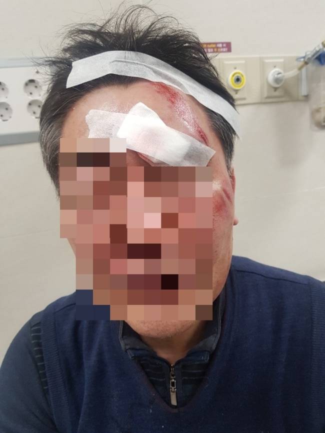 <사진설명> 폭행피해자 사진.