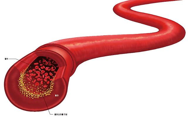 ⓒ 일러스트 정현철