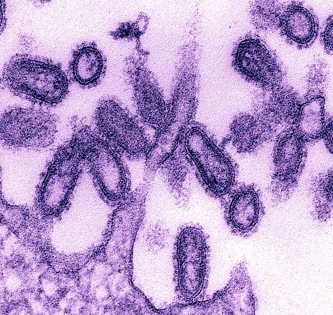 스페인 독감의 원인 바이러스 형태