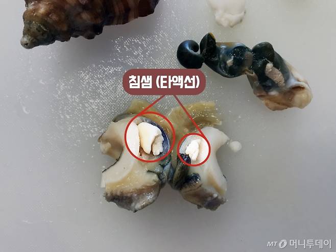 소라의 타액선(침샘) 위치 /사진= 함혜강에디터