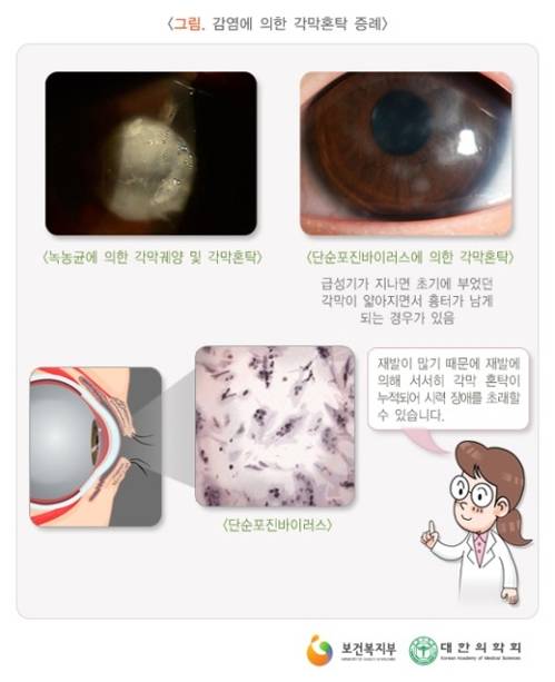 [출처=국가건강정보포털 의학정보]