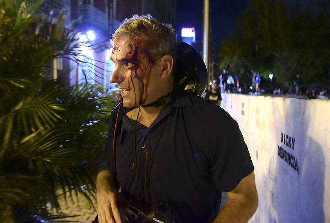 17일 산후안에서 열린 시위를 취재하던 게티이미지 사진작가 조 레이들 (Joe Raedle)의 머리에서 피가 흐르고 있다. 시위 현장은 전쟁터를 방불케했다. [AP=연합뉴스]