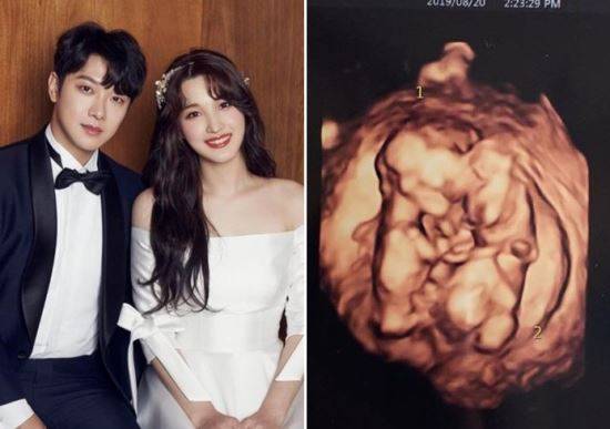 연합뉴스/율희 인스타그램