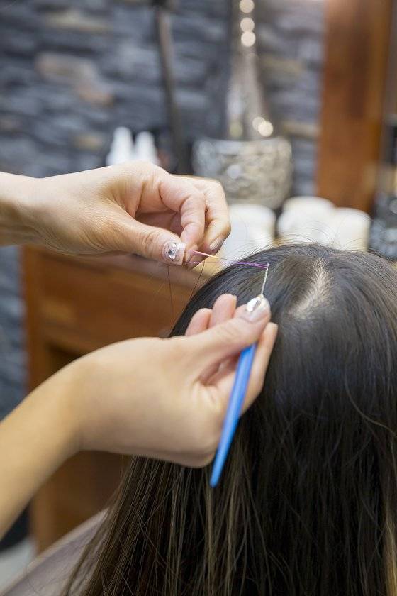 트윙클을 정교하게 하기 위해 코바늘로 불리는 스킬바늘을 이용해 시술한다.