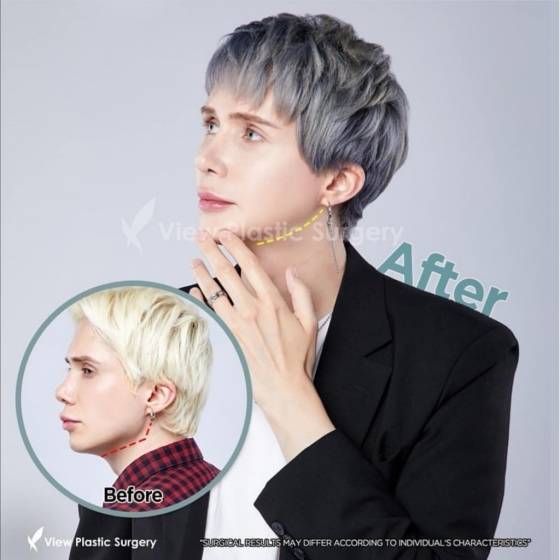 올리 런던. /사진=스타뉴스(올리 런던 제공)