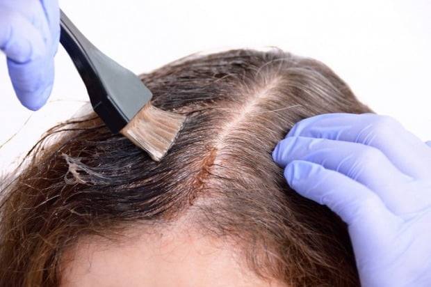 천연 성분 염색약이라고 홍보·판매되던 '헤나 염색약'을 사용한 뒤 피부가 착색되는 등 부작용을 겪고 있다는 주장이 제기됐다./사진=게티이미지