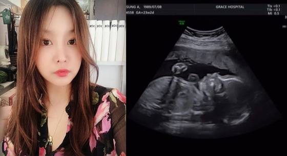 손성아. /사진=손성아 인스타그램 캡처