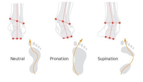 좋은 자세(neutral)의 보행. 발바닥 아치가 무너지는(pronation:회내) 보행. 발의 아치가 너무 큰(supination:회외) 보행. [자료 김병곤]