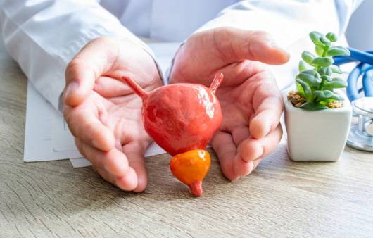 전립선 모형을 들고 있는 비뇨의학과 전문의