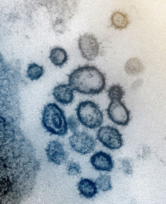 '코로나19 바이러스 현미경 촬영 사진 (자료 : NIAID')