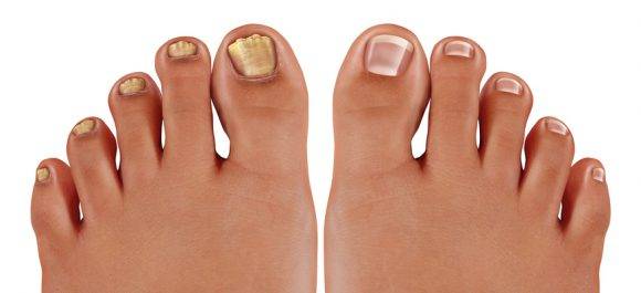 [사진=wildpixel/gettyimagesbank]