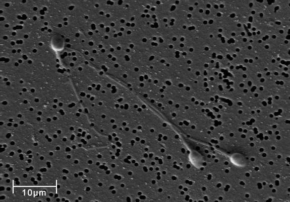 전자주사현미경으로 3,140배 확대한 인간의 정자. 위키피디아 제공