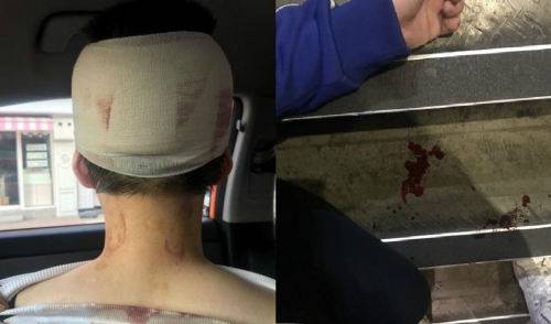 A씨 측이 “화장을 하지 않고 머리가 짧다는 이유만으로 폭행을 당했다”고 올린 피해 사진. 온라인 커뮤니티 캡처