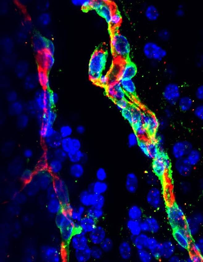 신경 혈관 구조 = 뇌의 혈뇌장벽을 유지하는 신경 혈관 내피세포(적색)와 주변세포(녹색).   이들 두 유형의 세포는 뇌혈관의 안정성을 지키는 중요한 역할을 한다.  [MPI B. Sheikh 제공 / 재판매 및 DB 금지]