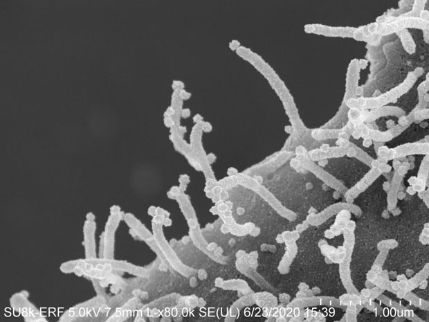 코로나19 바이러스에 감염된 세포는 파도타기하듯 다른 세포로 ‘좀비 촉수’를 뻗는다./사진=UC샌프란시스코(UCSF)