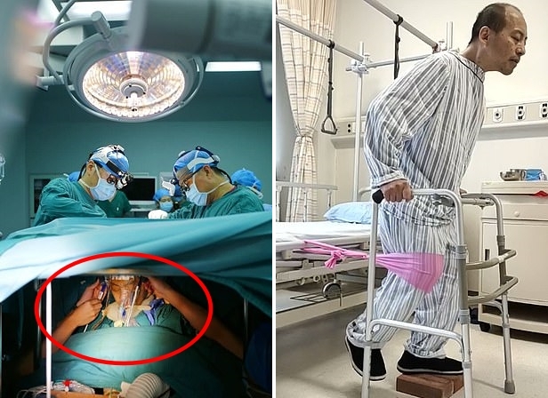 왼쪽은 몸이 완전히 구부러진 상태에서 수술을 받는 리 씨의 모습, 오른쪽은 수술 후 앞을 바라본 채 재활 훈련을 하는 모습