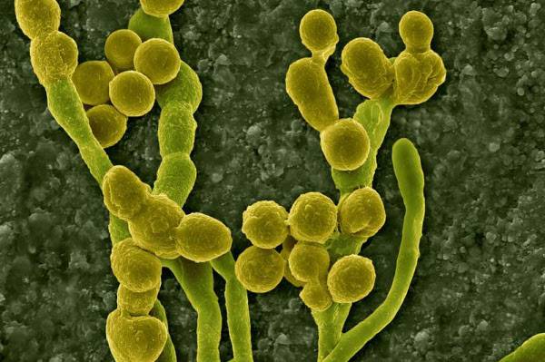 체르노빌 원전 사고 현장에서 채집한 클라도스포리움 곰팡이의 전자현미경 사진. 우주정거장에서 우주방사선을 차단하는 능력이 입증됐다./DENNIS KUNKEL MICROSCOPY