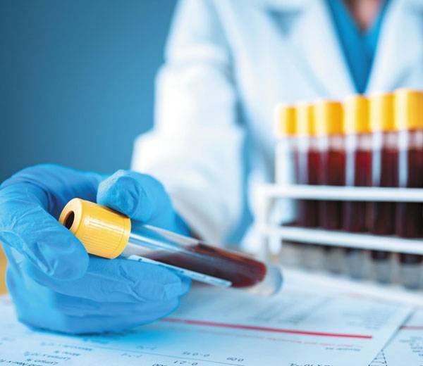 9월 1일부터 1964년생은 C형간염 혈액검사를 받을 수 있다./게티이미지뱅크