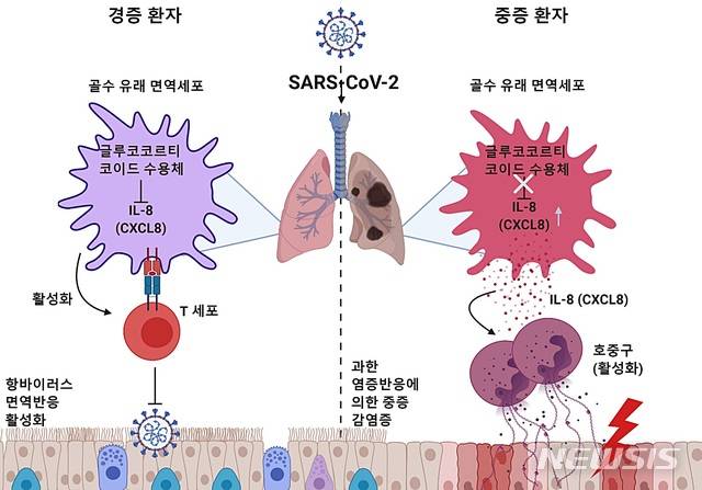 [대전=뉴시스] 코로나19 경증 환자들은 당질코르티코이드 수용체의 높은 발현으로 CXCL8의 발현이 억제돼 호중구 유입이 조절받고 있지만 당질코르티코이드 수용체 발현이 낮은 중증 환자들은 CXCL8의 발현이 높아져 호중구의 유입이 증가된다. 이럴 경우 호중구의 과도한 염증성 반응에 의해 폐 조직 상피세포들이 손상을 입고 심한 호흡기 증상을 보이게 된다.