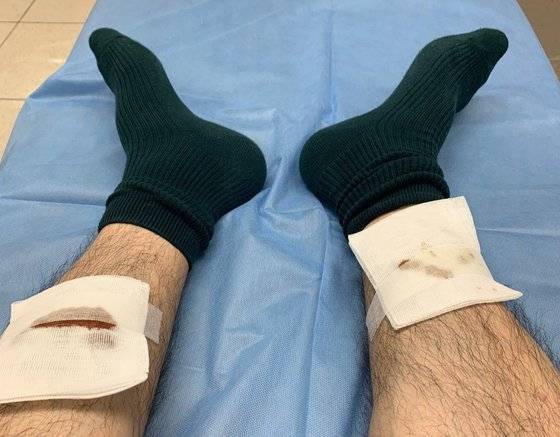 지난 3일 오후 5시쯤 경기 파주시에 위치한 아파트 1층 엘리베이터에서 B씨(33)씨가 개에게 물려 사고를 당했다. [B씨측 제공]