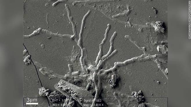 이탈리아 연구진이 공개한 약 2000년 전 사망자의 유골에서 발견된 뇌세포 확대 모습
