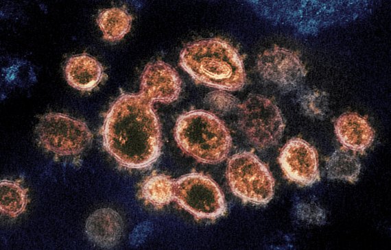 미국 국립 알레르기 전염병 연구소가 공개한 SARS-CoV-2LE 확대 사진.AP뉴시스