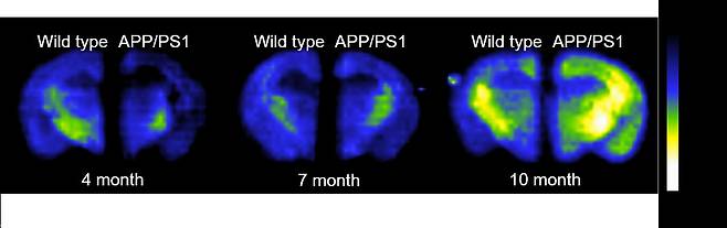 테라헤르츠 메타물질을 이용한 생쥐모델의 뇌에서 노화에 따른 아밀로이드 플라크 응집 정도 모니터링 (한국과학기술연구원 제공) 2020.11.01/뉴스1