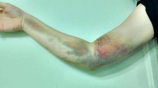 캐나다 CTV뉴스 제공