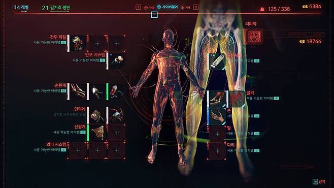 사이버웨어 임플란트 설치로 신체 개조도 가능하다.