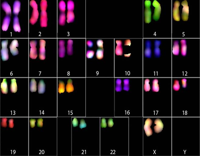 인간의 다양한 염색체의 모습을 보여주는 핵형 사진이다. 미국 연구팀이 이 가운데 X염색체의 염기서열을 끝에서 끝까지 결손 구간 없이 대부분 해독하는 데 성공했다. 네이처 논문 캡쳐