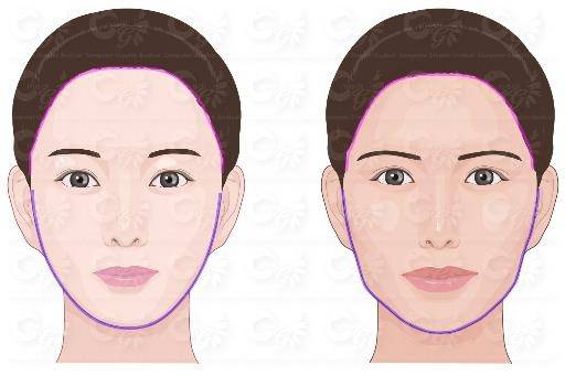 왼쪽은 한국인이 선호하는 얼굴, 오른쪽은 파라과이인이 선호하는 얼굴 (서울=연합뉴스) 왼쪽은 한국인이 선호하는 얼굴, 오른쪽은 파라과이인이 선호하는 얼굴, 3D 입체측정 결과 분석을 통해 한국인과 파라과이인이 선호하는 얼굴을 그림으로 나타냈다. 2020.12.30. [서울성모병원 제공. 재판매 및 DB 금지]