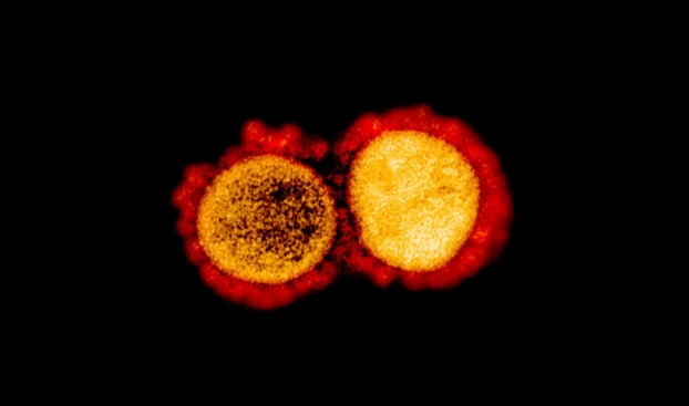 사스코로나바이러스-2(SARS-CoV-2)의 전자현미경 사진이다. NIAID 제공