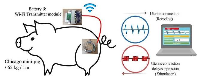 임신한 돼지의 자궁경부에 삽입된 전자약을 이용한 무선 자궁 수축신호 기록 및 전기자극을 통한 자궁 수축 지연·억제 실험 개념도. 전자약에 연결된 송신기를 돼지의 등에 별도로 부착하여 자궁 수축 신호를 측정 (한국과학기술연구원 제공) 2021.01.06 /뉴스1