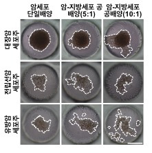 지방세포에 의한 암세포 이동현상 다양한 암세포(대장암, 전립선암, 유방암 세포주)를 지방세포와 함께 3차원 PDMS 칩에서 공배양(그림 가운데 및 오른쪽)하면, 암세포만 단일배양한 경우(그림 왼쪽)와 달리 암세포들이 이동하여 퍼져버리는 현상이 나타남/사진=서울대학교 전양숙/서지은