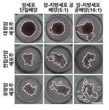 지방세포에 의한 암세포 이동 [전양숙 교수 제공. 재판매 및 DB 금지]