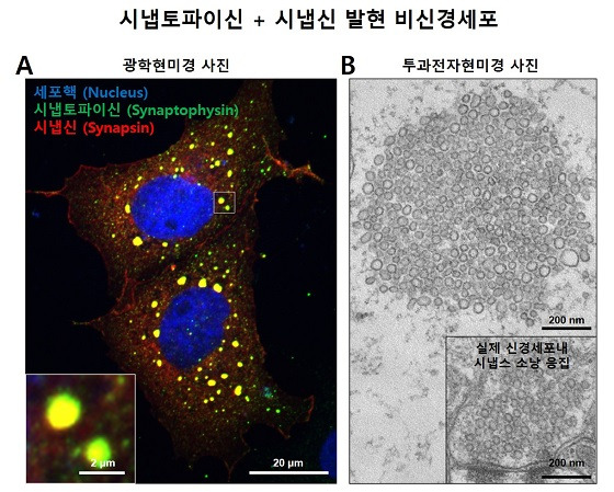 시냅토파이신과 시냅신에 의한 액체-액체 상분리 현상 및 비신경세포에서의 시냅스소낭 응집 모사 구조 형성(A) 비신경세포에 시냅토파이신과 시냅신을 발현시킨 후 광학현미경으로 관찰한 사진 (파랑: 세포핵, 초록: 시냅토파이신, 빨강: 시냅신). 세포내에서 동그랗게 뭉친 액체-액체 상분리현상을 볼 수 있다. (B) 단일 액체-액체 상분리현상을 투과전자현미경으로 본 모습. 하단의 실제 신경세포에서 관찰되는 것과 유사한 소낭들의 응집구조를 비신경세포에서 재현하였다.   출처 : 미국 예일대학교 박대훈 박사후연구원