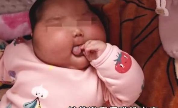 호르몬 함유된 유아용 크림 발라 얼굴이 부풀어 오른 중국 생후 5개월된 유아[바이두 캡처.재판매 및 DB 금지]