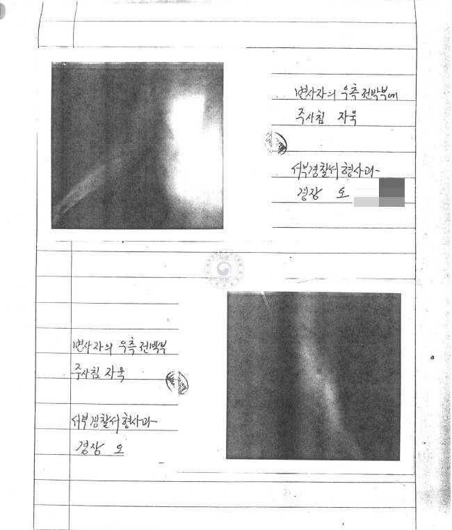 단독 입수한 김성재 사체검안서. 사망 당일 작성된 검안서상 오른팔 주사 자국 사진. 당시 검안에 입회한 경찰은 폴라로이드 카메라로 사체를 찍었는데, 이는 사망 추정 시각을 미궁에 빠뜨린 치명적 실수였다. 유가족 제공