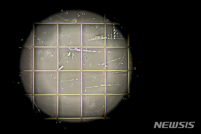 [멜버른=AP/뉴시스]2018년 호주 멜버른의 한 대학에서 현미경에 나타난 정자 샘플. 신종 코로나바이러스 감염증(코로나19)이 심각한 경우 남성의 정자 질에 영향을 미쳐 불임을 초래할 수도 있다는 새로운 연구 결과가 28일(현지시간) '생식'(Reproduction)에 발표됐다고 CNN이 보도했다. 2021.1.29.