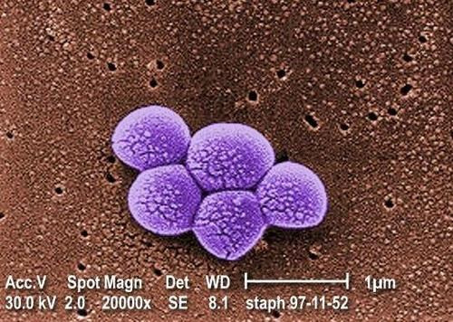 MRSA 그룹 메티실린 내성 황색포도상구균을 2만 배 확대한 전자현미경 이미지.   이 세균이 병원체로 돌변하면 치명적인 패혈증을 일으키기도 한다.   [미 CDC 홈페이지 캡처 / 재판매 및 DB 금지]