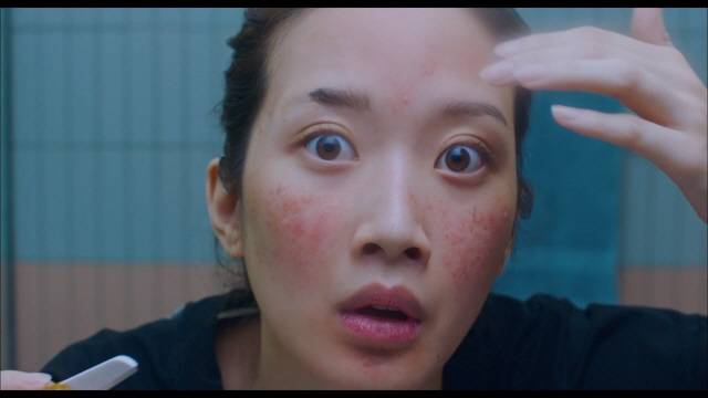 tvN 드라마 ‘여신강림’ 주인공 임주경이 앓은 피부 질환은 주사염이다./사진=tvN 드라마 ‘여신강림’ 캡처